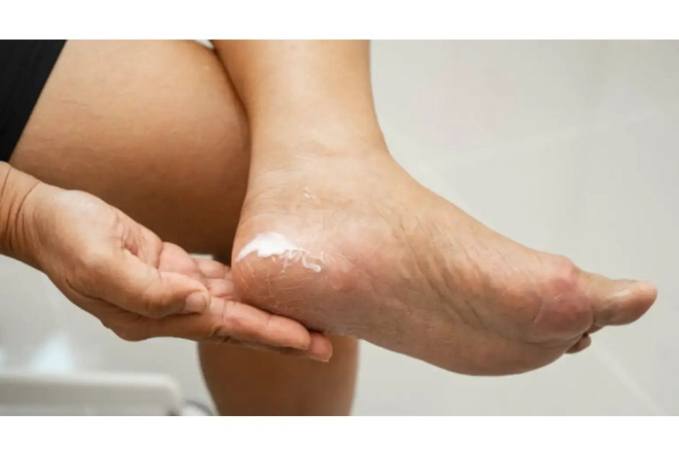 Ako sa správne starať o nohy pri cukrovke a predísť diabetickej nohe