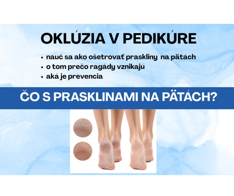 Čo s prasklinami na pätách?