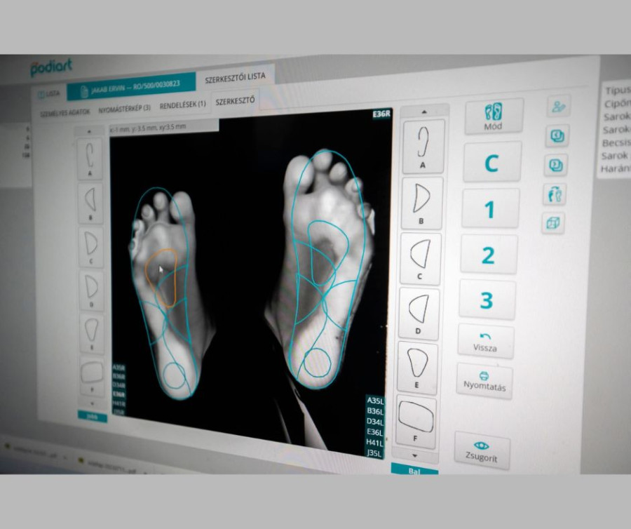 Podologická analýza chodidla v klinickej praxi(PREZENČNÉ ŠKOLENIE)