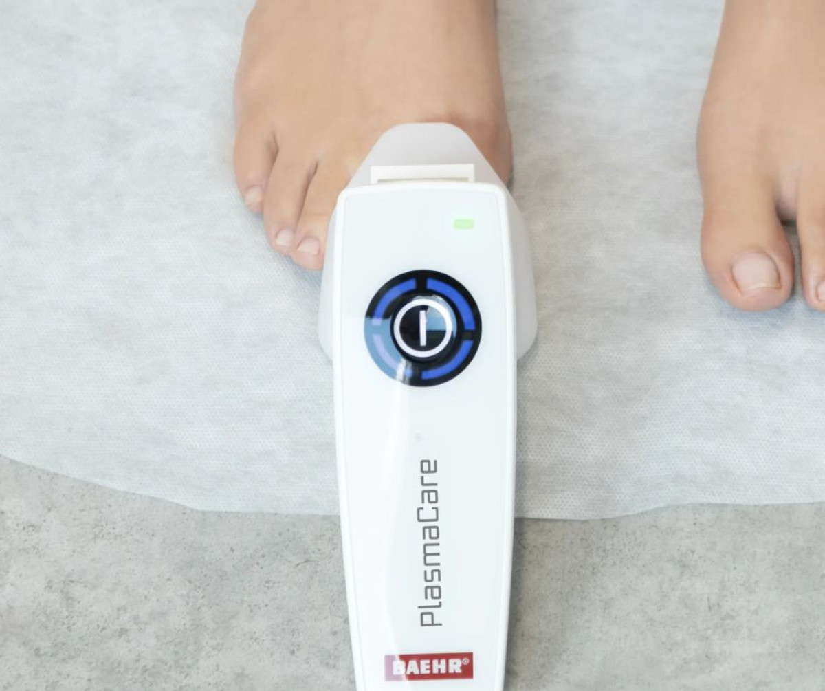 PlasmaCare, sada na liečbu nechtovej mykózy