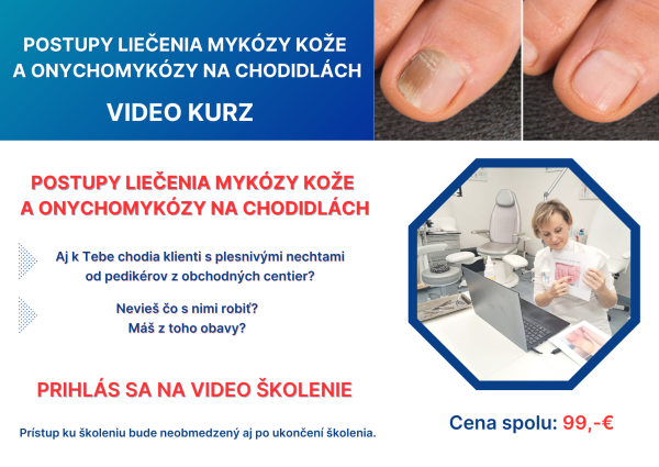 Postupy liečenia mykózy kože a onychomykózy na chodidlách (VIDEO KURZ)