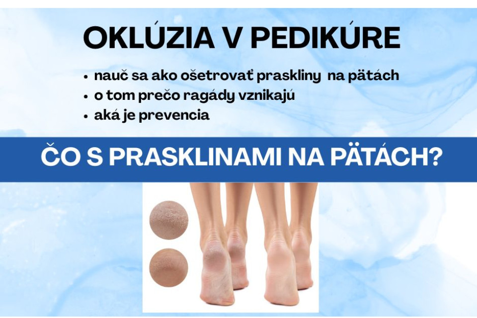 Čo s prasklinami na pätách?